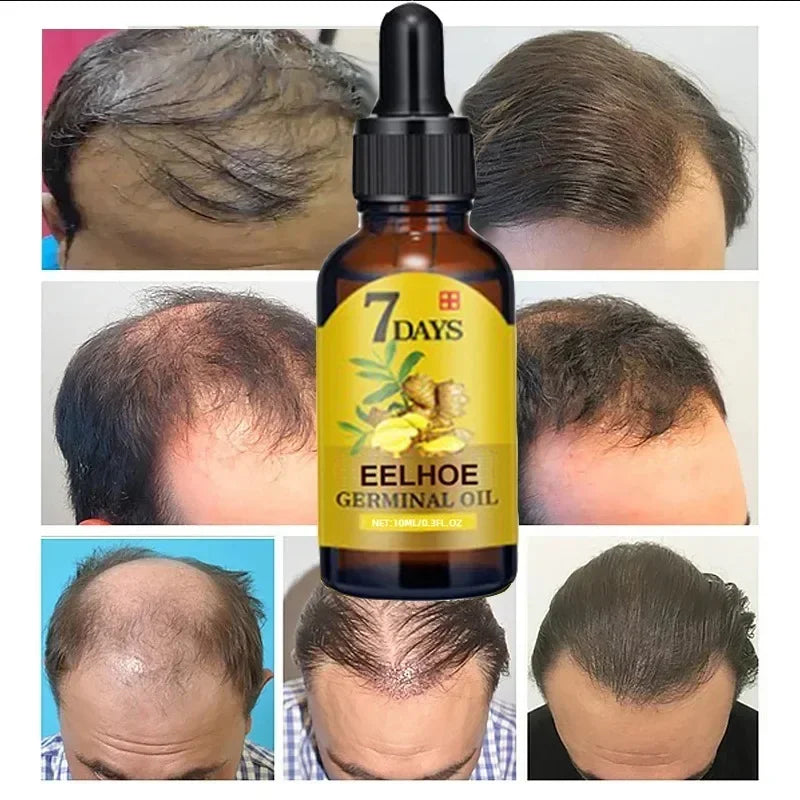 Anti Hair Loss Men Women Scalp Treatment Serum