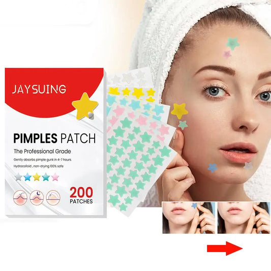 200pcs Pimple Patch  Sticker For Men Women