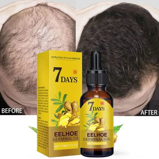 Hair Growth Serum Anti-loss Hair For Women Men